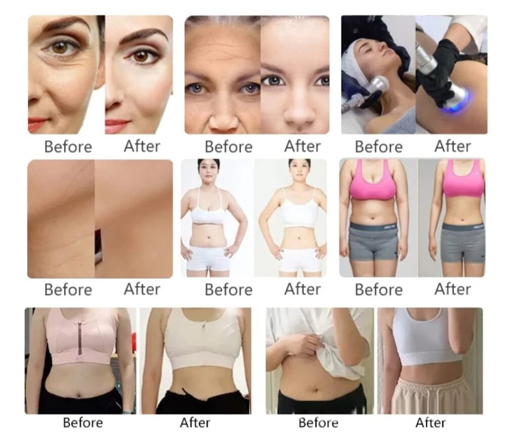 Cryo T Shock Hot & Cold Face & Body Machine - SkinSoft