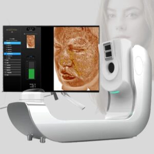 Skin Analyzer