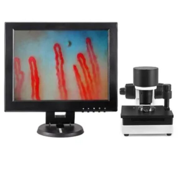 Microcirculation Test Machine Capillaroscope Analyzer - SkinSoft