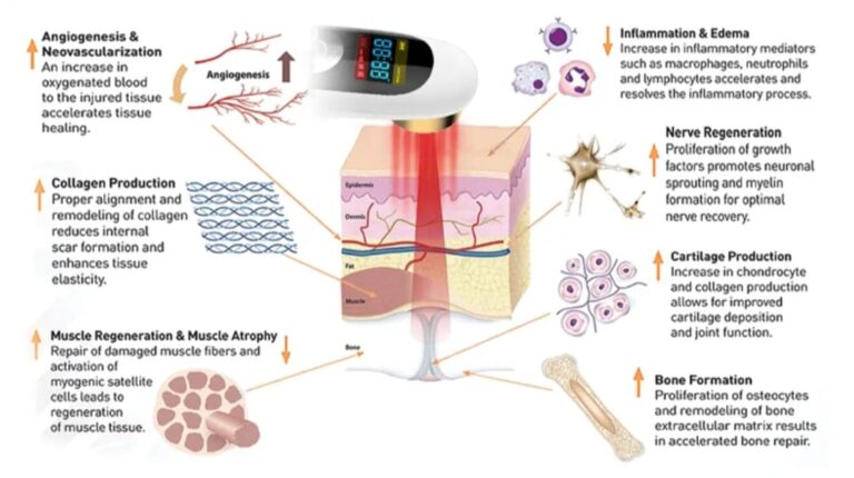 Pain Relief Cold Laser Therapy Device - SkinSoft